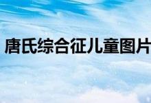 唐氏綜合征兒童圖片（唐氏綜合征形成原因）