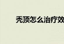 禿頂怎么治療效果好（禿頂怎么治）