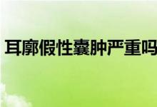 耳廓假性囊腫嚴(yán)重嗎（什么是耳廓假性囊腫）