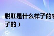 脫肛是什么樣子的它長在哪兒（脫肛是什么樣子的）