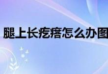 腿上長(zhǎng)疙瘩怎么辦圖片（腿上長(zhǎng)疙瘩怎么辦）