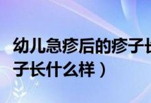 幼兒急疹后的疹子長(zhǎng)什么樣（幼兒急疹出的疹子長(zhǎng)什么樣）