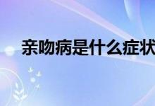 親吻病是什么癥狀（親吻病是什么病毒）