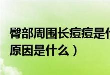 臀部周圍長痘痘是什么原因（臀部上長痘痘的原因是什么）