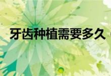 牙齒種植需要多久（牙齒種植需要多少錢）