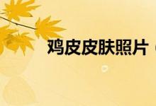 雞皮皮膚照片（雞皮皮膚怎么辦）