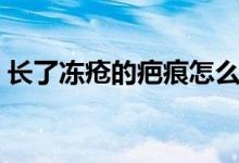 長(zhǎng)了凍瘡的疤痕怎么去除（凍瘡很癢怎么辦）