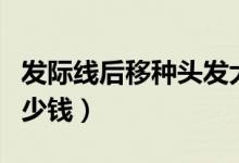 發(fā)際線后移種頭發(fā)大概多少錢（種頭發(fā)一般多少錢）