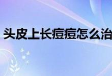 頭皮上長(zhǎng)痘痘怎么治（頭皮上長(zhǎng)痘痘怎么辦）