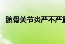 髕骨關(guān)節(jié)炎嚴不嚴重（髕骨關(guān)節(jié)炎會好嗎）