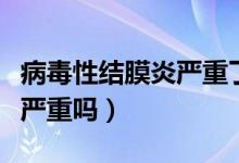 病毒性結(jié)膜炎嚴(yán)重了會怎么樣（病毒性結(jié)膜炎嚴(yán)重嗎）