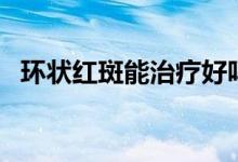 環(huán)狀紅斑能治療好嗎（環(huán)狀紅斑能治好嗎）