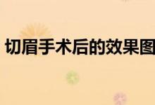 切眉手術(shù)后的效果圖片（切眉手術(shù)后的費(fèi)用）