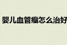 嬰兒血管瘤怎么治好點(diǎn)（嬰兒血管瘤怎么治）