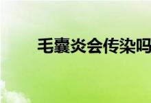 毛囊炎會傳染嗎（毛囊炎會傳染嗎）