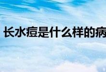 長(zhǎng)水痘是什么樣的病毒（長(zhǎng)水痘是什么樣的）