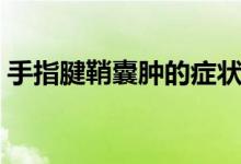 手指腱鞘囊腫的癥狀(手指腱鞘囊腫的癥狀)